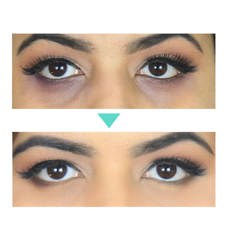 Crema para Contorno de Ojos con Retinol 2.5% | 30 ml