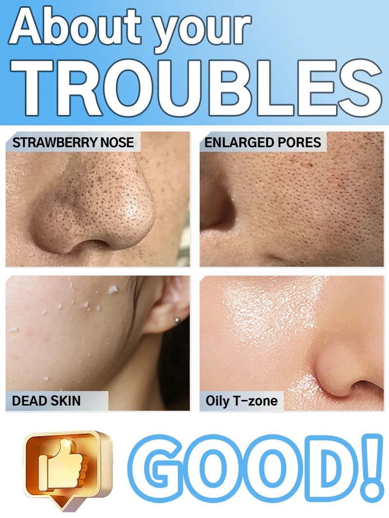 Ultrasonic Skin Scrubber Blackhead Remover Deep Pore Cleaner Facial Cleansing Device Exfoliator