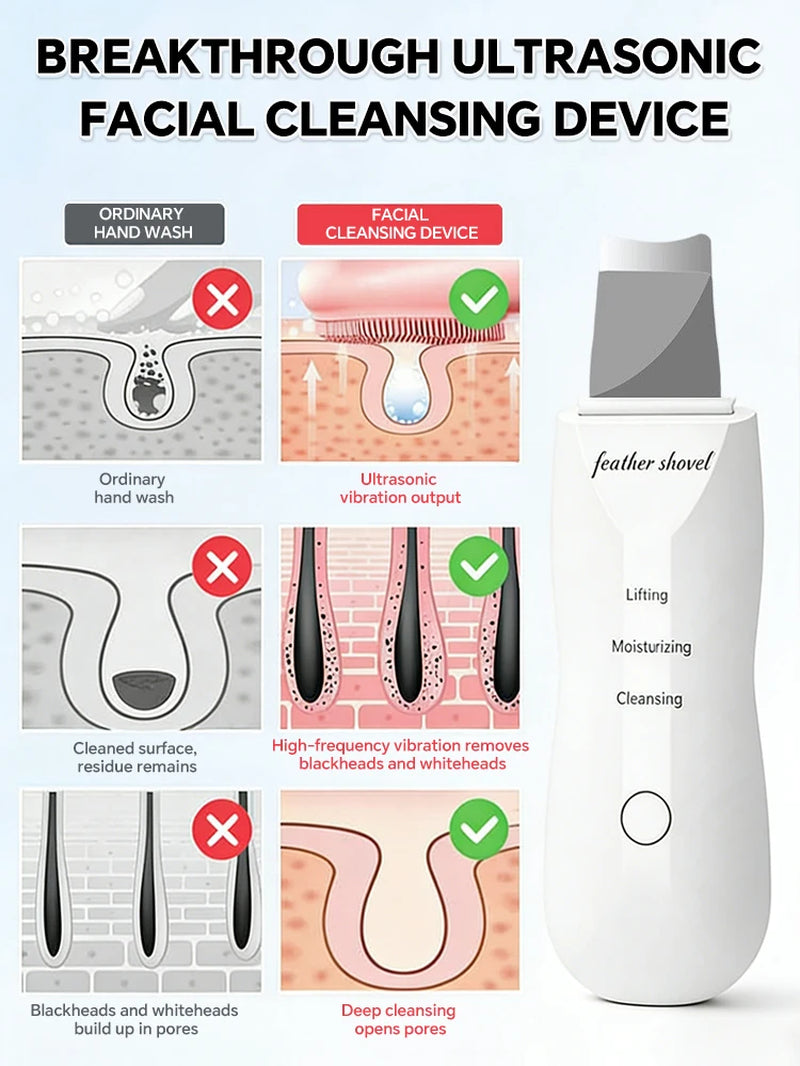 Ultrasonic Skin Scrubber Blackhead Remover Deep Pore Cleaner Facial Cleansing Device Exfoliator