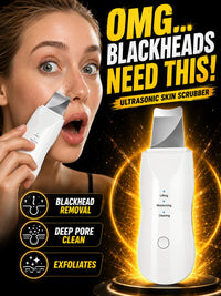 Ultrasonic Skin Scrubber Blackhead Remover Deep Pore Cleaner Facial Cleansing Device Exfoliator