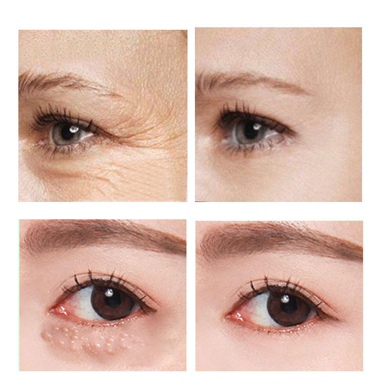 Crema para Contorno de Ojos con Retinol 2.5% | 30 ml