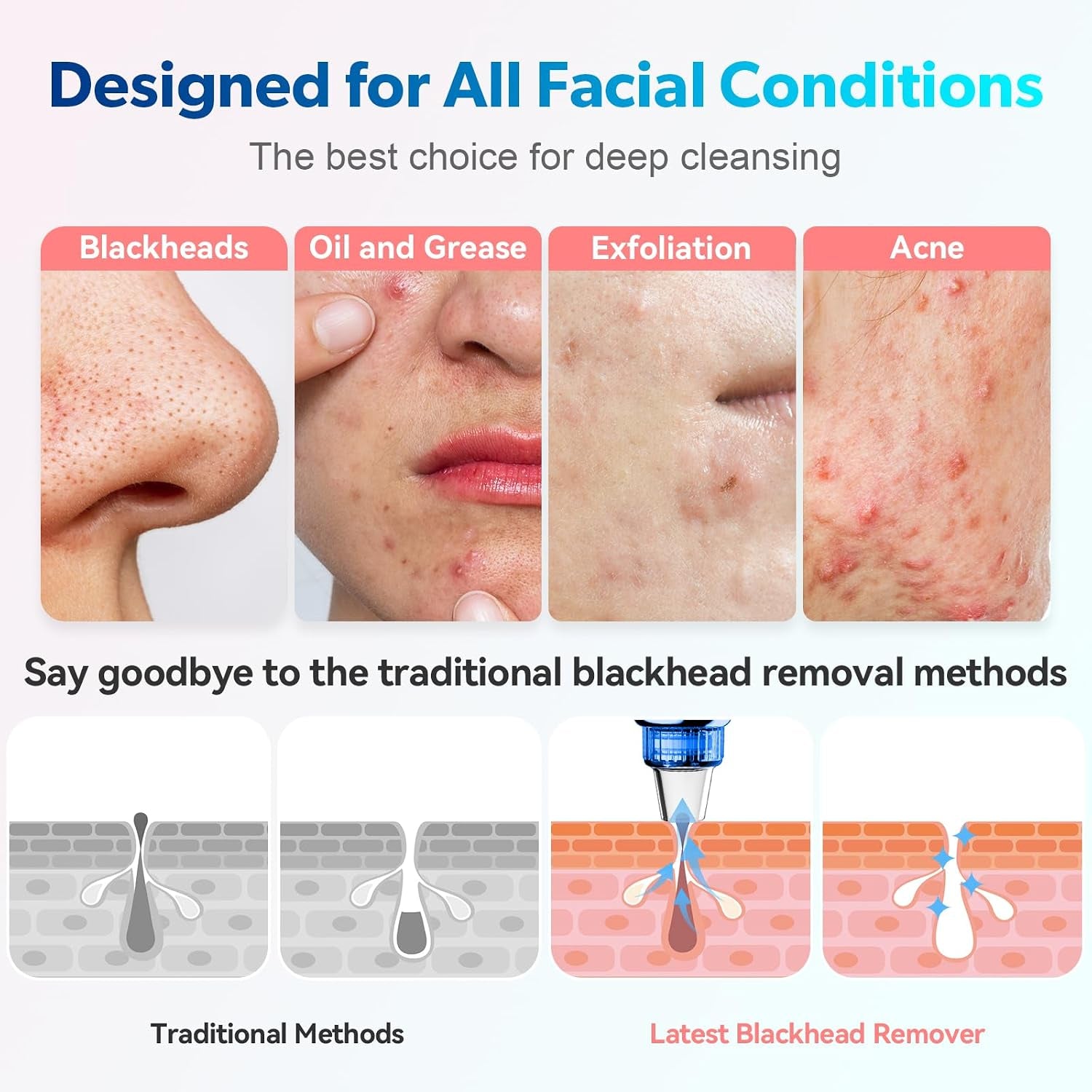 Blackhead Remover Pore Vacuum, USB Rechargeable Face Pore Cleaner Tool