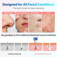 Blackhead Remover Pore Vacuum, USB Rechargeable Face Pore Cleaner Tool