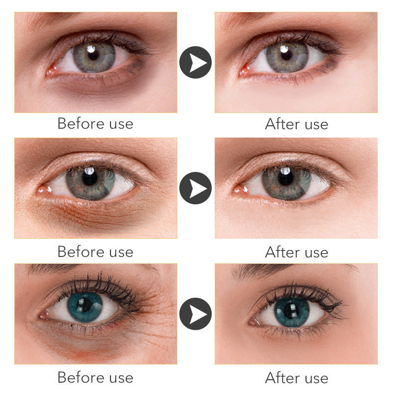 Crema para Contorno de Ojos con Retinol 2.5% | 30 ml
