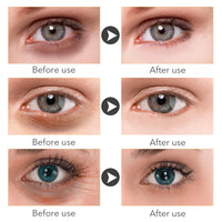 Crema para Contorno de Ojos con Retinol 2.5% | 30 ml