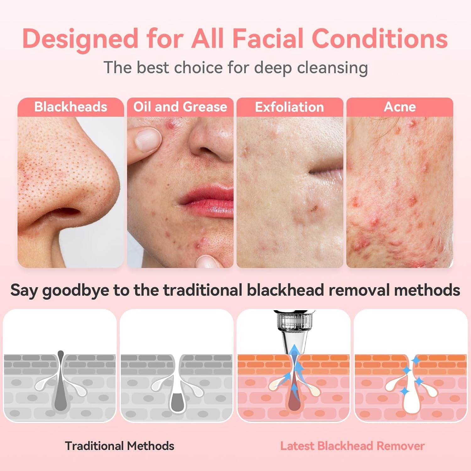 Blackhead Remover Pore Vacuum, USB Rechargeable Face Pore Cleaner Tool